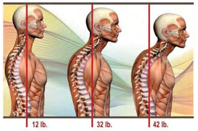 Weight of a forward head